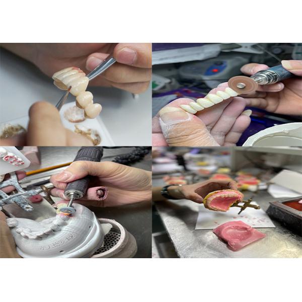 Full Arch Implant Bridge with High-Strength CoCr Metal Framework and Premium Porcelain Layering for Precision Fit