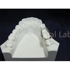 Quality Adjustable Retainer Expander Convenient Orthodontic Solution Easy Maintenance wholesale