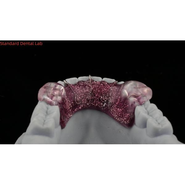 Teeth Expansion And Distalization Adjusting Expander In Mouth Orthodontist Palate Expander
