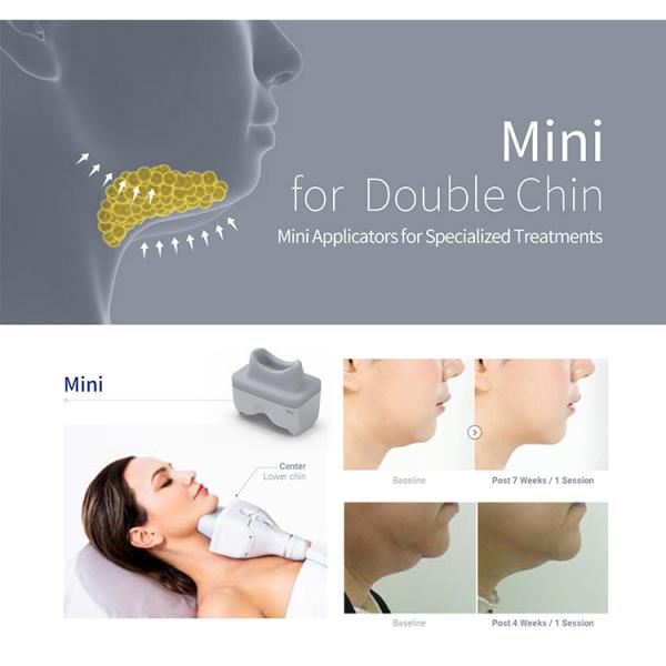 690nm Led Cryolipolysis Fat Freezing Machine Ac110v