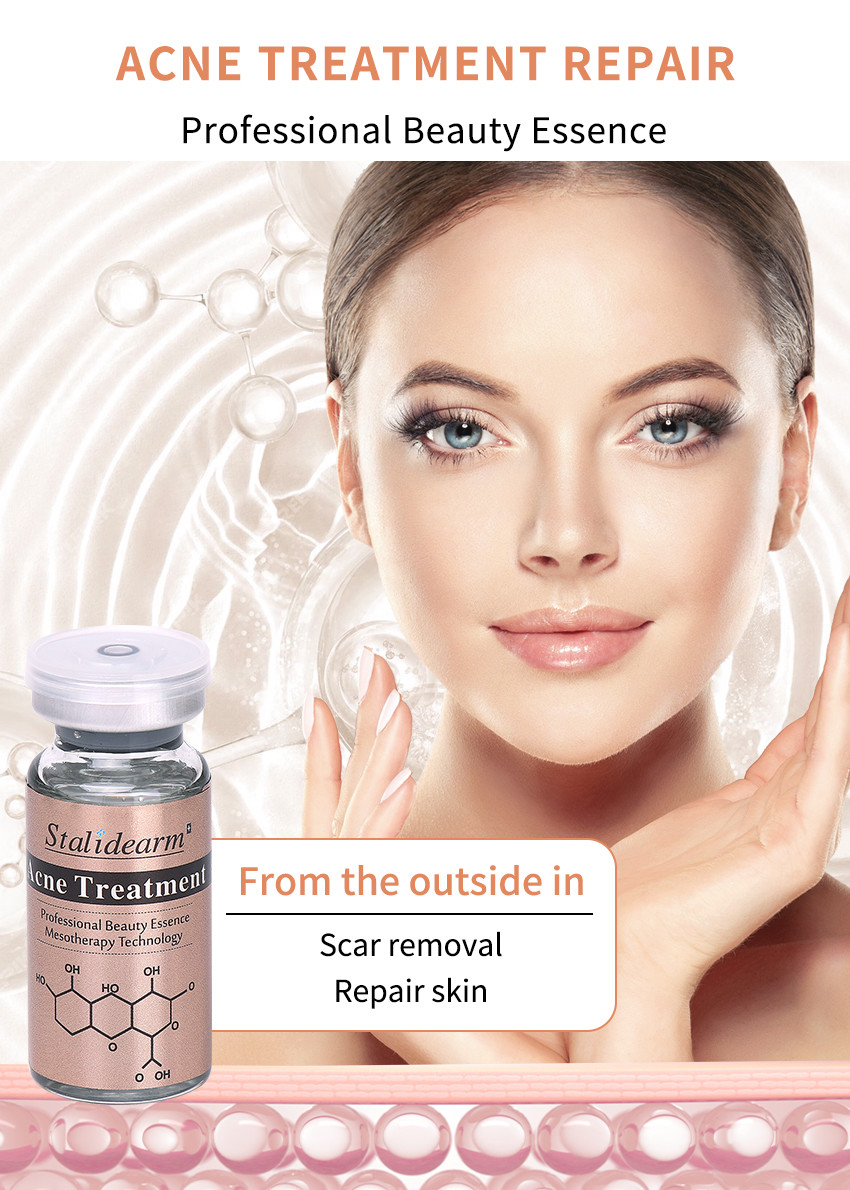 Best Quality Anti Hair Loss Care Treatment Scalp Care Prevent Hair Loss Hair Growth Serum