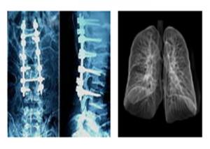 Quality Sharp Radiographic Medical X Ray Films , Mri Dr Ct Digital Dry Imaging Film wholesale