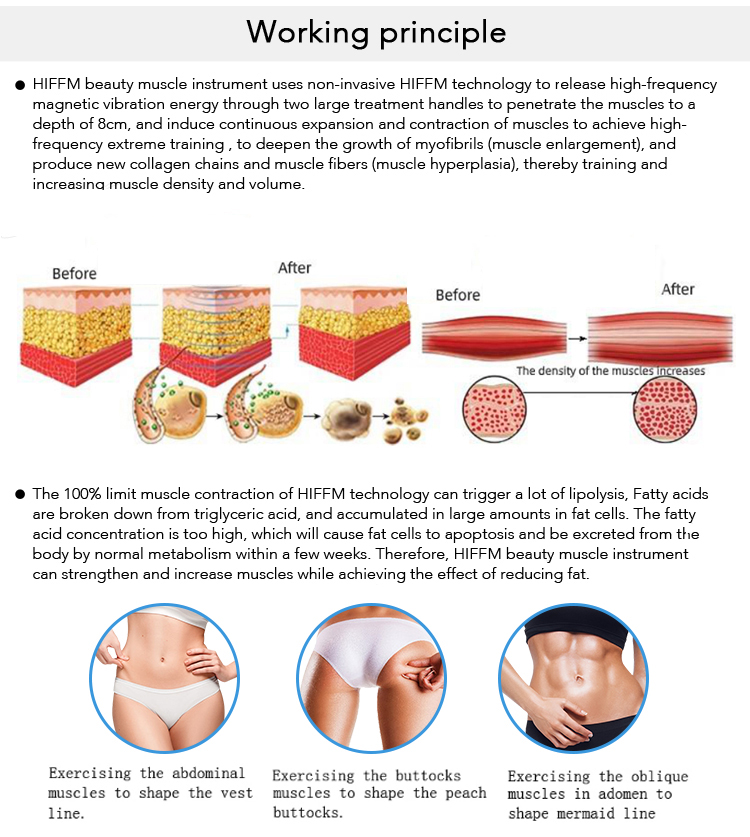 Fat Removal Cryolipolysis Fat Freeze Slimming Machine EMS Cryo Body Sculpting