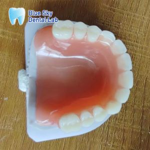 Missing Teeth Acrylic full Denture Restoration Acrylic Complete Denture