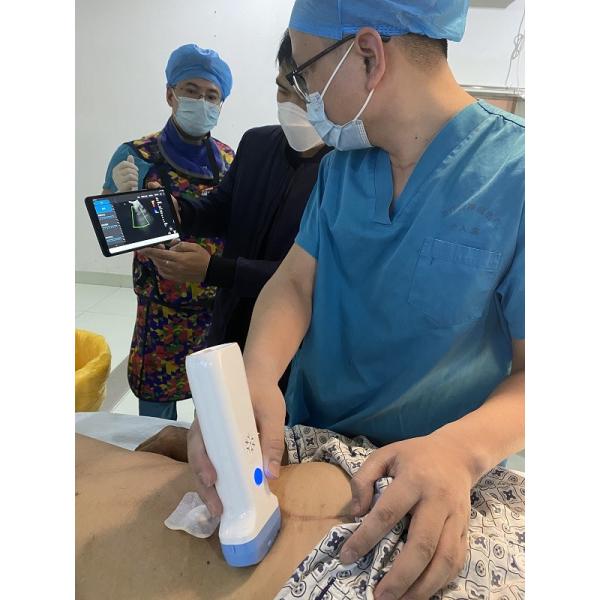 6000mAh Wireless Ultrasound Probe 128 Element Wifi Ultrasound CE