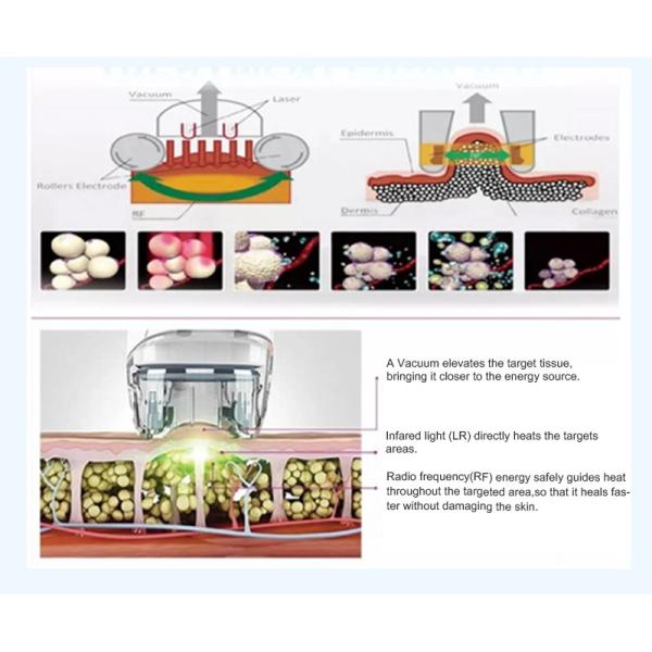 Velaslim Infrared Laser Vacuum Rolling Anti-Cellulite Rf Skin Tightening Machine Manufacturer、