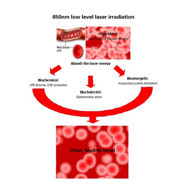 low-level-laser watch.jpg