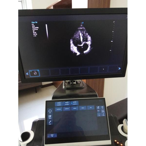 New arrival DW-T8 Elastography trolley ultrasonic scanner 4D cardiac color doppler ultrasound with TDI