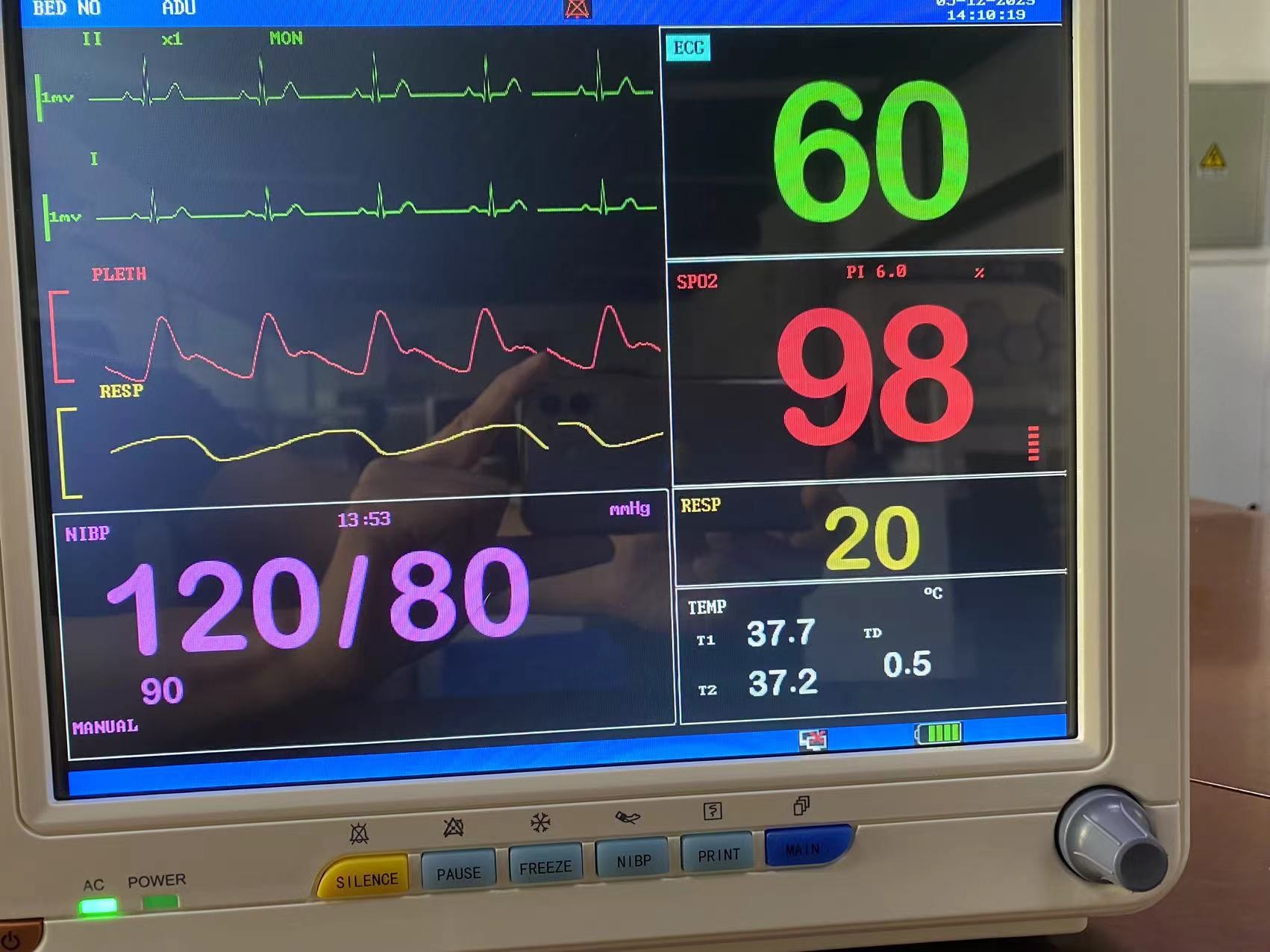12.1 Inch TFT LCD Screen Portable Cardiac Patient Monitor ECG SPO2 NIBP Vital Signs Monitors