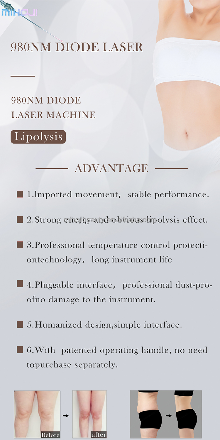 980nm Laser Liposuction Machine Portable Diode Laser for Vascular Removal