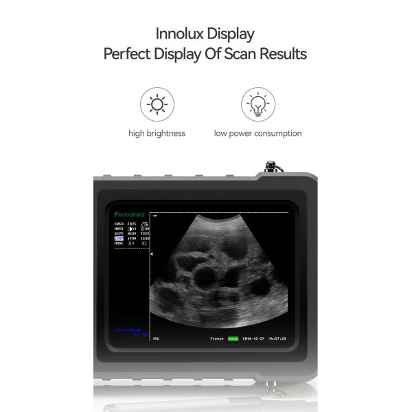 Yonker Veterinary Ultrasound Pregnancy Ultrasound Scanner for Animal Dog Vet Portable Digital Ultrasound