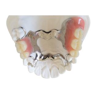 China OEM 3D Printer PFM Dental Crown Bridge High Biological Intermiscibility on sale