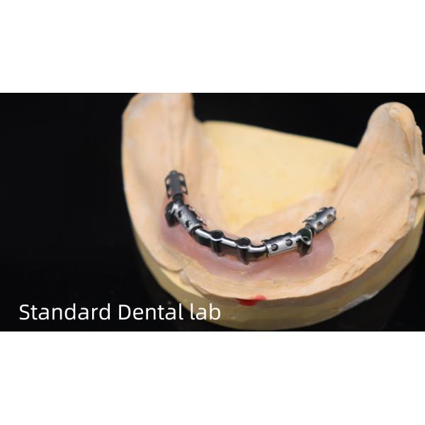 Titanium Implant Supported Dentures Precise Ivoclar Denture Over Implants