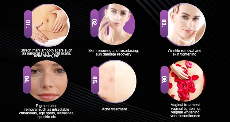 10600nm CO2 Fractional Laser Machine For Removal Acne Wrinkle Skin Rejuvenation