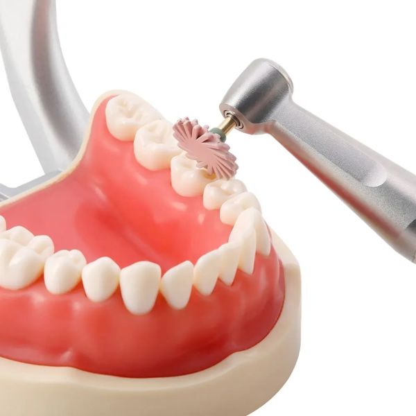 Dental Polishing Discs HighQuality Resin Polishing Tool for Dental Care