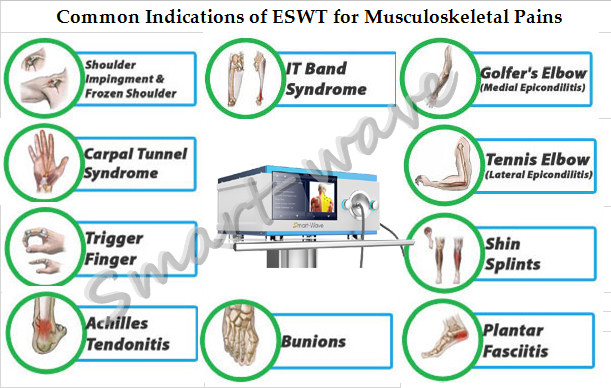 Electromagnetic shock wave therapy pain relief extracorporeal shock wave therapy equipment foot care shock wave