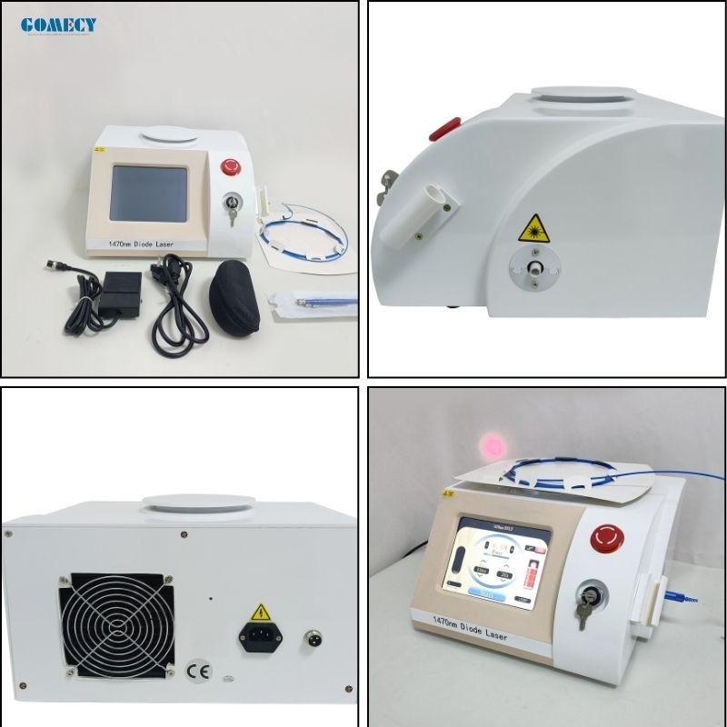 Minimally Invasive 1470nm Diode Laser Vein Removal Machine for EVLT Treatment Solutions