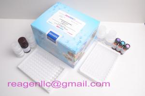 Quality urea enzymatic assay kit,96T wholesale