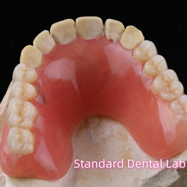 Dental Temporary Acrylic Partial Denture Ivoclar YAMAHACHI