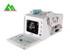 Digital Medical Ultrasound Equipment Human Ultrasound Scanner With LCD Display