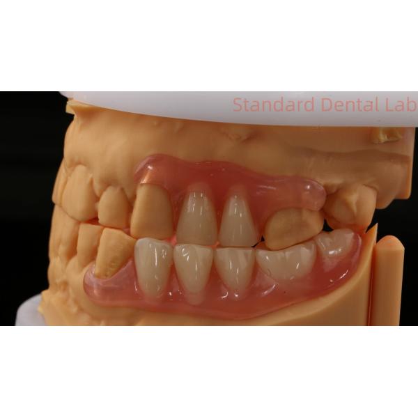 Dental TCS Valplast Flexible Partial Dentures Dental Lab 3D Print Model High Esthetics