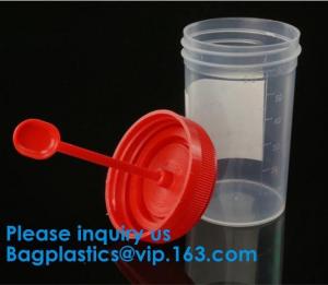 China Urine Container, Disposable Urine Collector Urine Specimen Container,Urine Specimen Cup,Sterile or Non Sterile on sale
