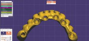 Quality Full Anatomy Dental Crown Design Implant Bridge Screw Retained wholesale