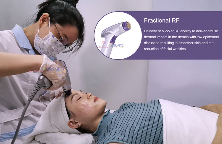 Fractional Rf Microneedle Radio Frequency Skin Tightening Machine