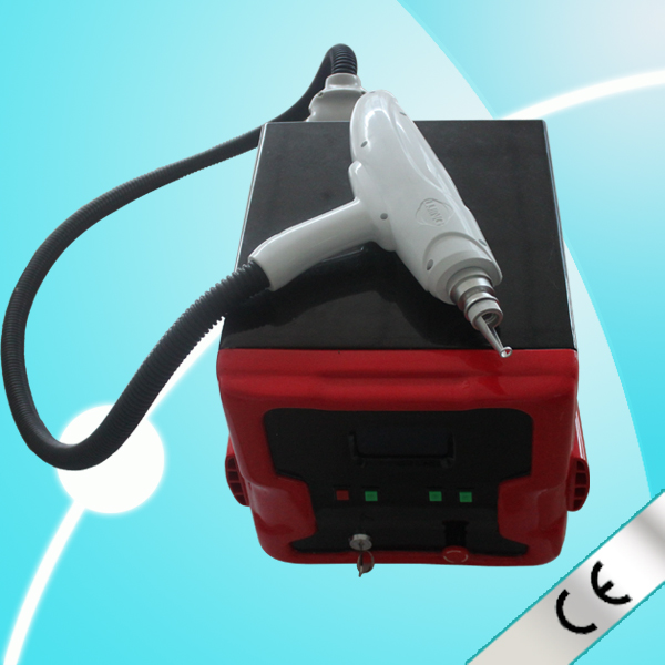laser machine to remove tattoo