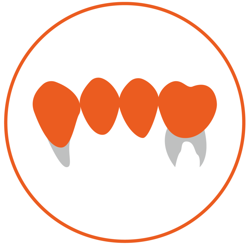 Precision-Engineered Cad Cam Zirconia Blocks SHT-ML for High-End Restorations