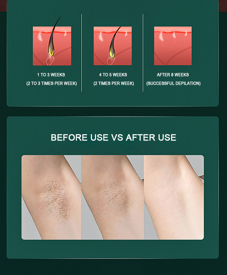 999999 Pulses Home Laser Hair Removal Device