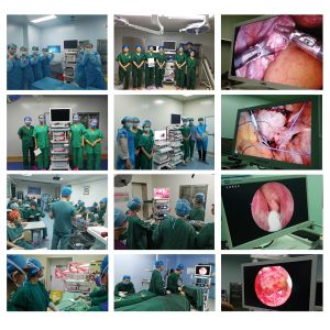 Laparoscopy Hospital Surgical Instruments Medical Endoscopy Camera System For