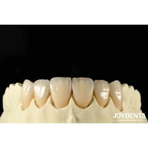 Quality Bionic Development Leaves And Distinct Layers Of Zirconia All-Ceramic wholesale
