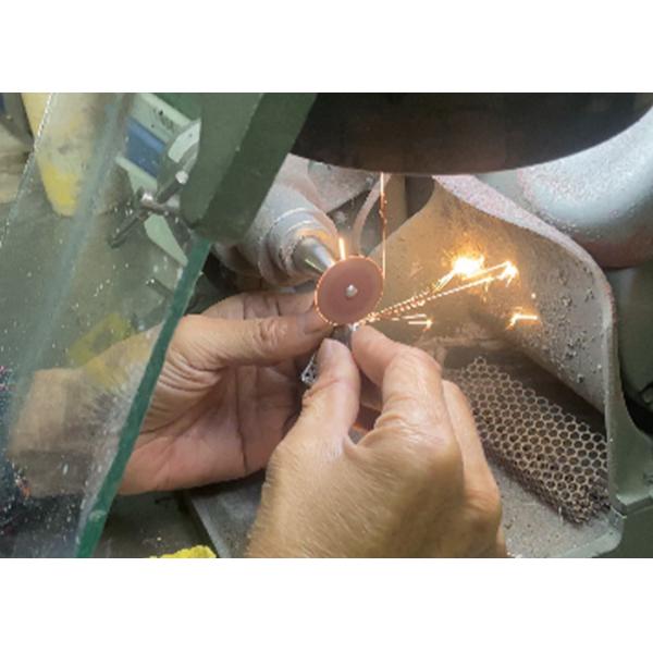 Easy Fit Cast Partial Denture Restores Chewing And Speaking Ability