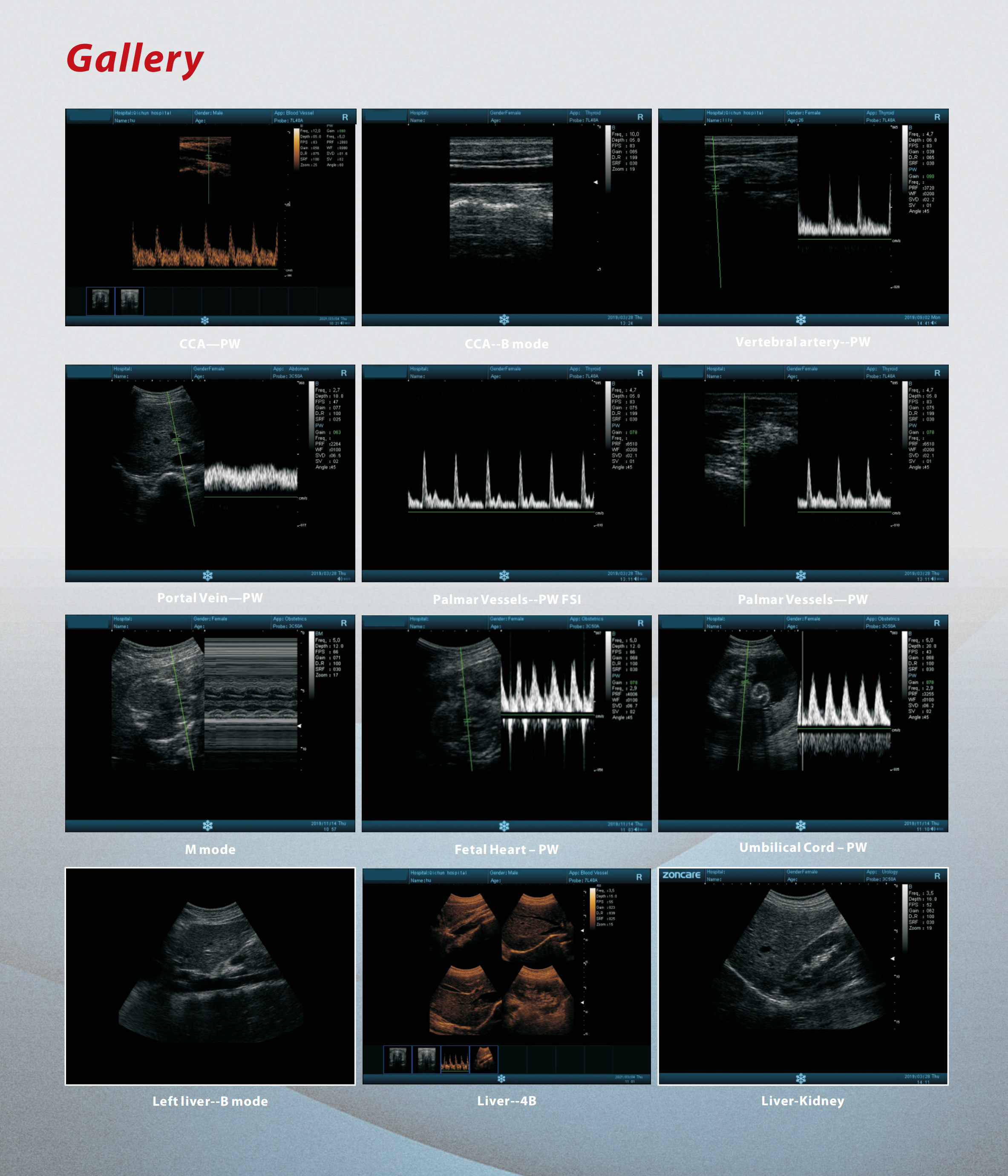Diagnostic B/W Ultrasound System All Digital For Obstetric And Gynecologic Hospital