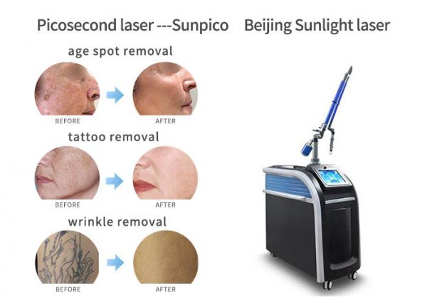 Cheap Vertical Picosecond Laser Tattoo Removal Machine Pigmentation Removal Acne Treatment for sale