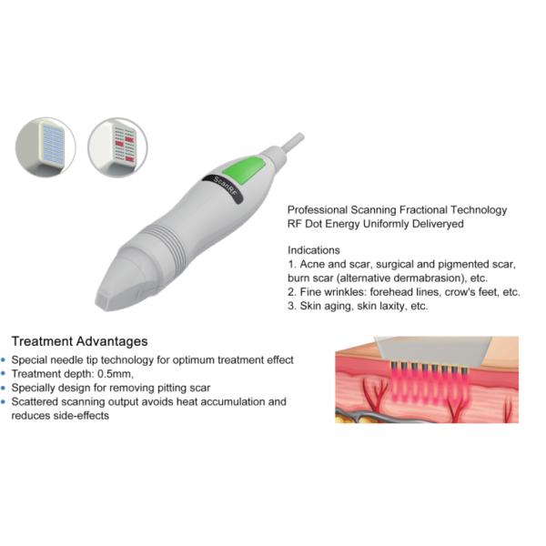 RF 1MHz Acne Treatment Machine 15 Inch Display Scar Treatment