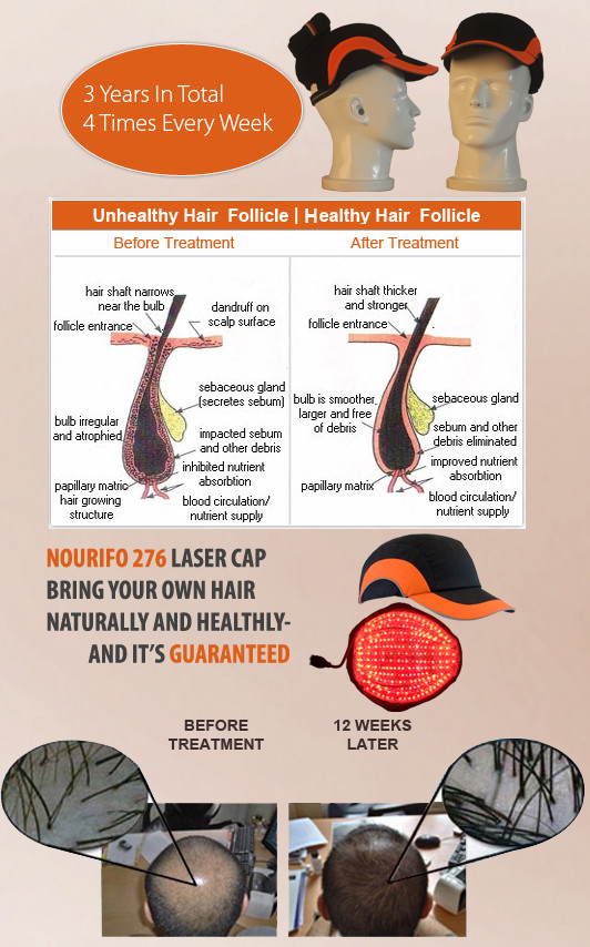 Quality 2017 laser cap/laser comb wholesale