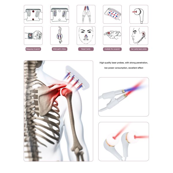 High Blood Pressure Laser Therapy Watch 650nm 450nm For Hypertension Management