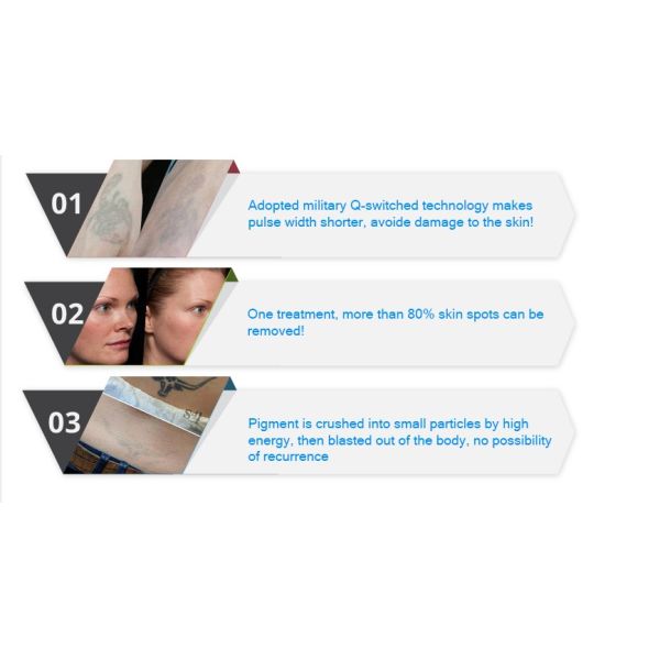 NUBWAY Tattooist Wanted Factory Beauty Skin Rejuvenation Pore Removal 755nm 1064nm 532nm Picosecond Laser Machine