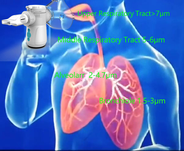 Baby Cough Medic Mesh Nebulizer Treatment Portable 3.13μm For Bronchiolitis
