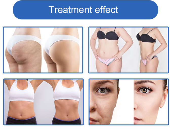 Fat Reduction And Weight Loss Machine 360 Cryolipolysis Body Contouring Slimming Device For Fat Freezing