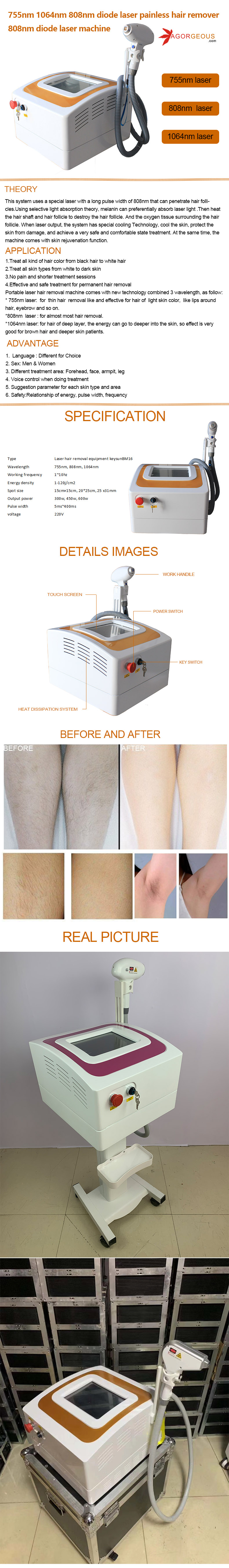 Diode Laser Hair Removal Beauty Machine Painless 808nm Home Use