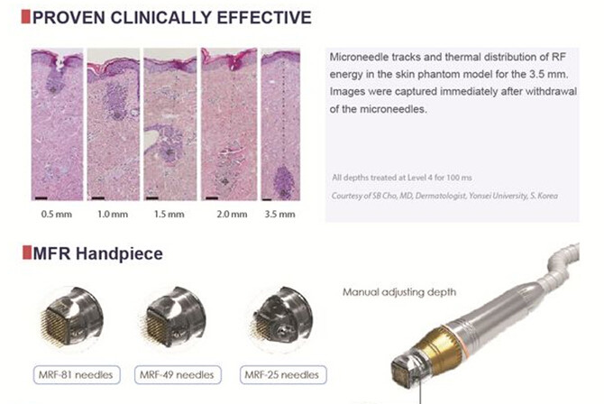 Dermapen microneedle machine secret microneedle fractional rf system microneedle treatment