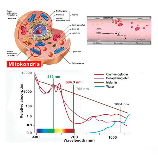 High Blood Pressure Laser Therapy Watch 650nm 450nm For Hypertension Management
