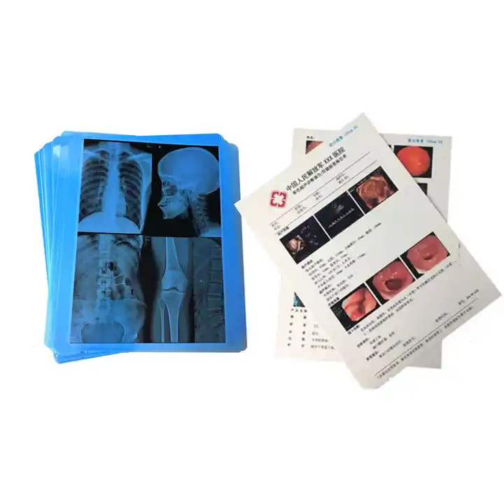 125/150/180 Microns Blue Medical Film Inkjet Perfect for Medical Imaging Equipment