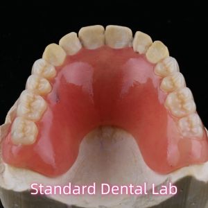 Quality Dental Temporary Acrylic Partial Denture Ivoclar YAMAHACHI wholesale