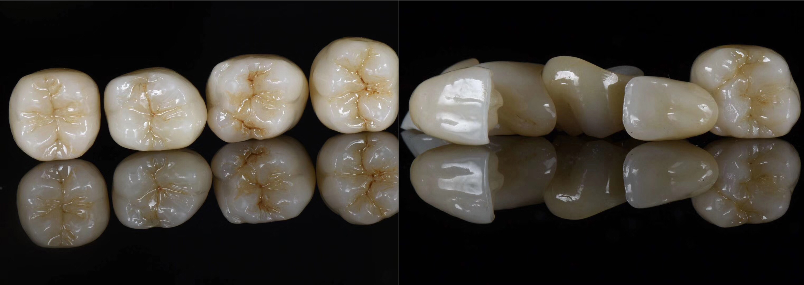 98x10mm White 1200MPA Dental Zirconia Blank For Lab