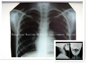 Quality Digital Medical X Ray Dry Film 14 x 17inch Health Imaging Radiographic Film wholesale