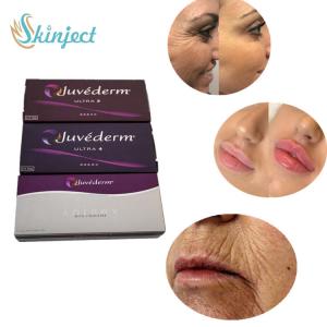 China Juvederm Ultra 4 Dermal Filler Lip Injections For Sexy Lips Enhancement on sale